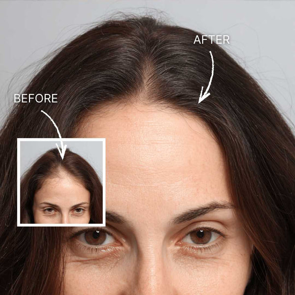 30-Day Hair Strength & Growth System